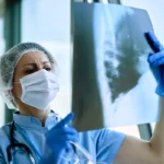 Asbestosis, un riesgo del amianto para tu salud