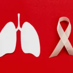 Cáncer de pulmón por exposición al amianto